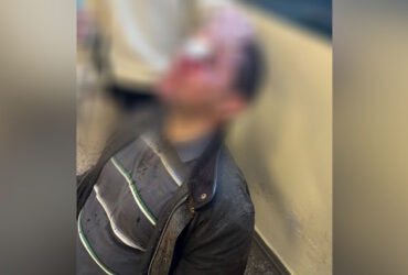 Επίθεση στη Νομική Σχολή: «Τελειώσατε τώρα» φώναζαν οι κουκουλοφόροι που χτύπησαν με πυροσβεστήρα φοιτητή