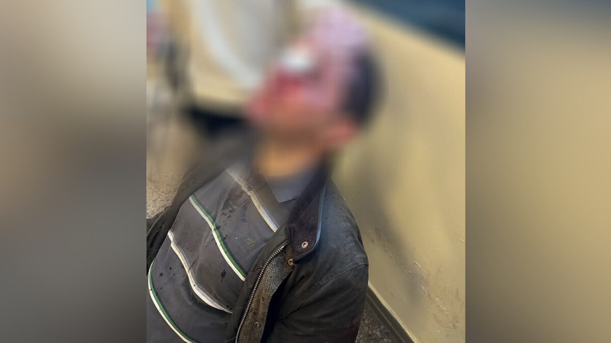 Νομική: Στο μικροσκόπιο οι κάμερες ασφαλείας για τον εντοπισμό των 8 κουλουφόρων που χτύπησαν φοιτητή – Τι ερευνά η ΕΛ.ΑΣ Νομική: Στο μικροσκόπιο οι κάμερες ασφαλείας για τον εντοπισμό των 8 κουλουφόρων που χτύπησαν φοιτητή – Τι ερευνά η ΕΛ.ΑΣ