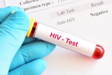 Νέα εποχή στη μάχη με τον ιό HIV: Οι ΗΠΑ ενέκριναν φάρμακο που θα μπορούσε να σταματήσει τη μετάδοση