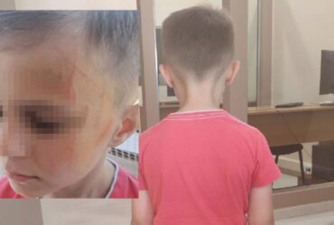 Αγρίνιο: Πεντάχρονοι έδειραν συμμαθητή τους σε νηπιαγωγείο – Του είχαν ζητήσει να βγάλει τα ρούχα του