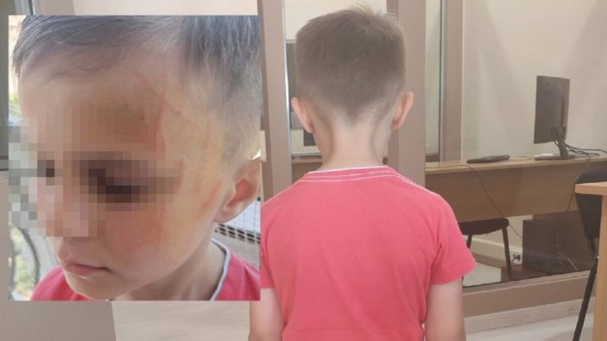 Αγρίνιο: Πεντάχρονοι έδειραν συμμαθητή τους σε νηπιαγωγείο – Του είχαν ζητήσει να βγάλει τα ρούχα του Αγρίνιο: Πεντάχρονοι έδειραν συμμαθητή τους σε νηπιαγωγείο – Του είχαν ζητήσει να βγάλει τα ρούχα του