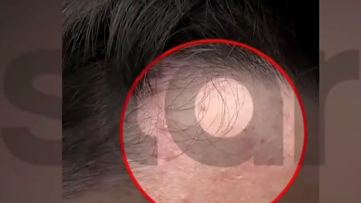 Άγριος ξυλοδαρμός 14χρονου σε σχολείο – Τον χτύπησαν συμμαθητές του για μια πάσα στο μπάσκετ Άγριος ξυλοδαρμός 14χρονου σε σχολείο – Τον χτύπησαν συμμαθητές του για μια πάσα στο μπάσκετ